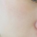 올리브약국 | 약국 재생크림 파이토신 내돈내산 (올리브영 vs 약국 피부템) 후기
