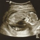 일산제일산부인과의원 이미지