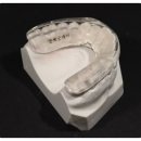 연세굿데이치과의원 | [공지] 잠실새내역치과 스플린트 후기 부작용 주의할 점