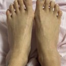 시원의료기중앙점 | 에버바디 발가락 교정기 PRO 무지 외반증 교정 후기