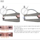 평화의안 이미지