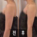 더라인씨앤에스 서울지점 | 빼라리슬리밍센터 강남구청 웨딩관리 드레스라인 관리 승모근 박살 추천 후기