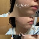 (주)아이소브 | 고농축 앰플 마스크팩 추천 | 메조 카밍 앰플마스크 II | 아이소브 마스크팩 사용후기