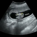 [덕계]선물 포장 방법 2차 | 임신 16주 17주 18주 19주 증상 2차기형아검사 초음파 식단 기록