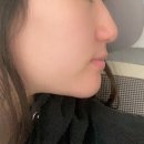 정양한방병원 | 간헐적 단식 효과처럼, 주사한방에 한달만에 5키로 살 빼는 법