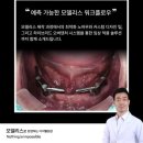 좋은날치과기공소 이미지