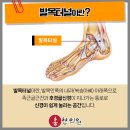동울산한의원 네이버블로그