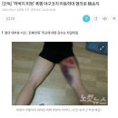 [단독] '허벅지 피멍' 폭행 야구코치 아동학대 혐의로 檢송치 이미지