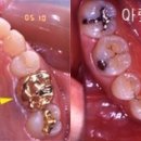연치과기공소 이미지