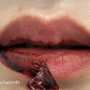 피그만클리닉 이미지