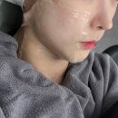 티타늄리프팅 80KJ 내돈내산 리얼후기