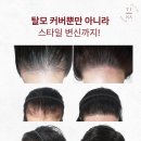 티나스칼프
