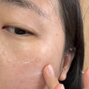 (주)노리아 | 노리아 트라닌크림 기미제거 사용 솔직후기