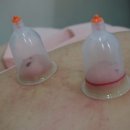 군산부부한의원 이미지