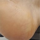 리오풋케어