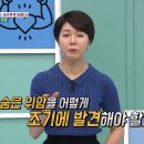 소리 없이 찾아온다! '숨은 위암'인 조기 위암 찾아내는 방법 이미지