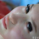 서울피부과 네이버블로그