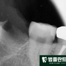 범플란트치과의원
