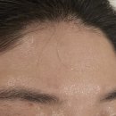 엘바디핏 이미지