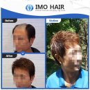 경기도 수원시 권선구 경수대로225번길 72 | 수원남자가발 자신감을 되찾게 해주는 수원 미소모 가발 후기