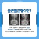 금천근본튼튼의원 네이버블로그