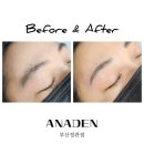 아나덴 슈가링왁싱 부산정관점 | [정관왁싱 / 기장왁싱] 아나덴 슈가링 왁싱샵 눈썹 왁싱 Before &amp; After