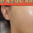 에스테리나