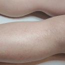 보떼샤인 | 성북구 보떼샤인 왁싱 후기