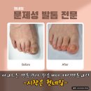 네일샵 반짝 | [봉천] 현네일 - 봉천역 네일샵 재방문 솔직후기! 자석젤 이달의아트 후기! 발톱교정 전문샵 추천!