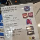 자궁경부암 검사 종류 세포검사, hpv바이러스, 확대촬영