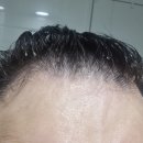 (주)디자인로움 | 남자 셀프염색 새치커버 샴푸 르베로 맥주효모