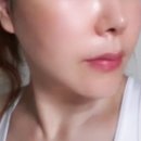 달뜰목 | 40대 안면거상 수술 한 달차 후기｜유봄성형외과 이마거상·목거상 실제 회복 기록