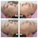 광주대주유소 | 송정동피부샵 올가드림뷰티 송정점 모공 &amp;두피디톡스 후기