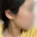 연세보드미의원 네이버블로그