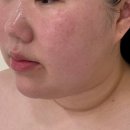 [양주/옥정] 윤곽관리를 위한 양주피부관리 &lt;클라온 에스테틱&gt;