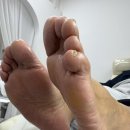네일오 | 병점발각질 반복된다면? 더네일오로지푸스 병점점 건식 발각질 관리 후기