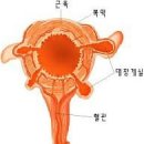 5대 질병의 원인 / 숙변의 정체 이미지