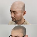 리게인프로젝트 이미지