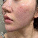 토비아 | 닥터토비아 피부장벽강화제 후기 :) 이지에프 연고 효과 제대로 느낀 연고형 재생크림 ✨