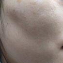디마크트리 | 여드름토너 레몬추출물로 만든 저자극 W피부연구소 트리몬 레몬토너