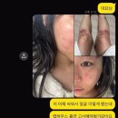 와이이오