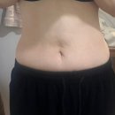 여리한다이어트 신림점 | 운동 없이 라인 잡고 싶다면 신림 웨딩관리 여리한다이어트신림점