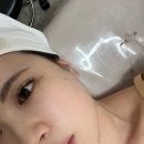 대구 대명동 피부관리 " 이엘뷰티 " ｜속건조피부 물방울리프팅 후기