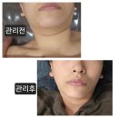 오늘은밝은피부