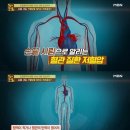 저혈압 기준, 증상 관리 제대로 하려면 이미지