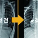 수원체형교정