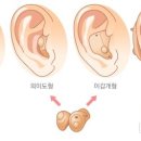 경산보은보청기 이미지