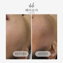 황금역 | 황금역 풀페이스왁싱 후기, 화장 안 먹던 피부가 달라졌어요! [대구 수성구 베이슈가링왁싱 황금점]