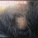 라잇나우 이미지