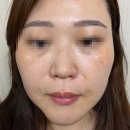 당산에스테틱 찾다가 반한 프라이빗 케어, 더스파엘 프라이빗 후기